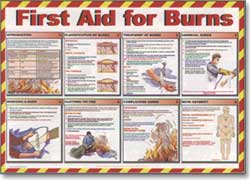 First Aid Poster - First Aid for Burns