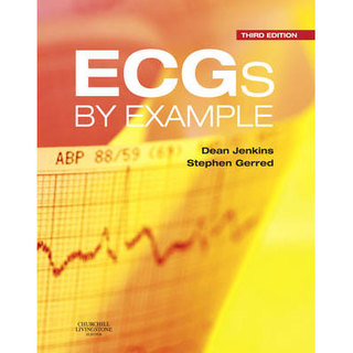 ECGs by Example - 3rd Edition