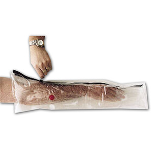Inflatable Splint - Long Arm