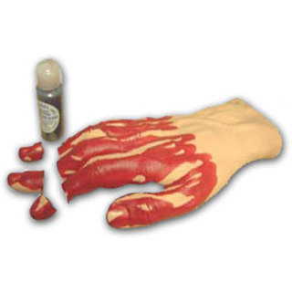 Non Bleeding Moulage - Hand with Severed Fingers