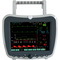 SP G3H Multi Parameter ECG/SPO2/NIBP/HR/RR/Temp Portable Patient Monitor thumbnail