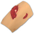 Bleeding Moulage - Compound Fracture Femur (Upper Leg)
